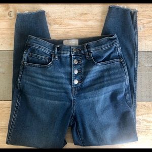 Everlane Vintage Button-Fly Skinny Jean